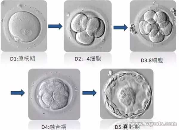 广州哪家代生靠谱,试管胚胎等级分类，二级胚胎是不是优质胚胎？_上海供卵试