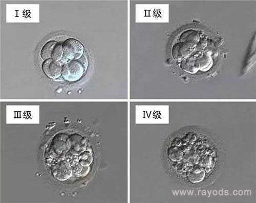 广州哪家代生靠谱,试管胚胎等级分类，二级胚胎是不是优质胚胎？_上海供卵试